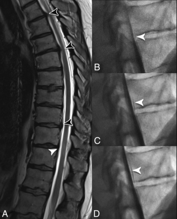 FIG 3.