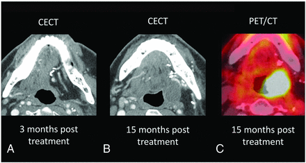 FIG 3.