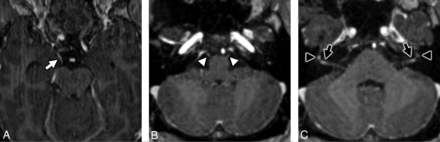 FIG 4.