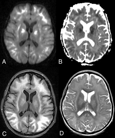 FIG 1.