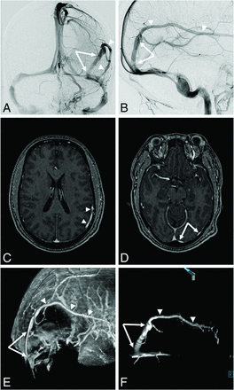 FIG 4.