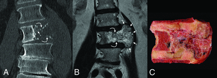 FIG 2.