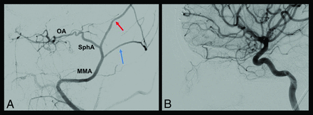 FIG 4.