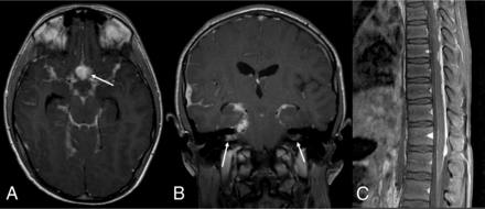 FIG 1.