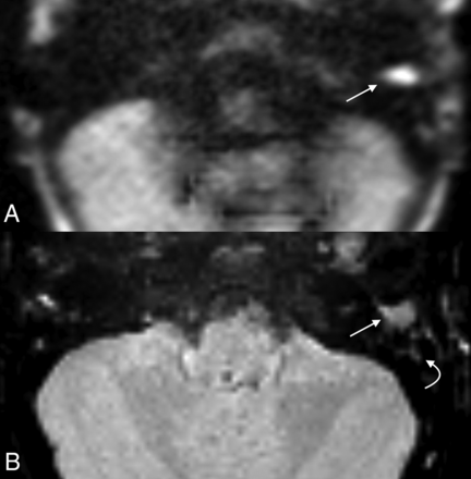 FIG 1.