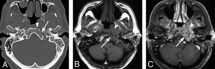FIG 1.