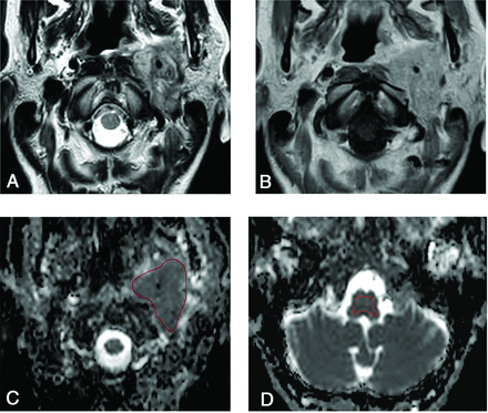 FIG 1.