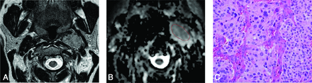 FIG 4.