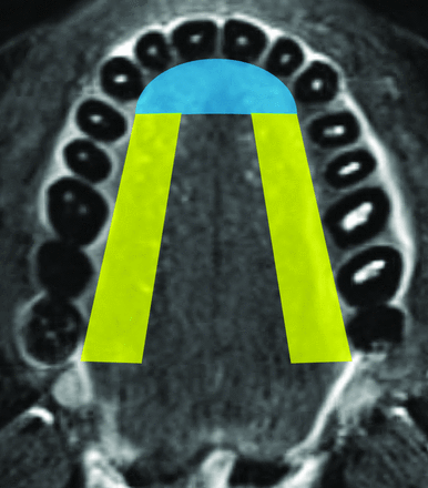 FIG 1.