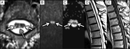 FIG 2.