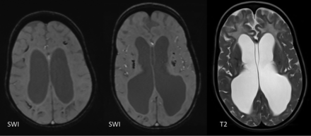 FIG 14.