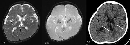 FIG 15.