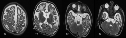 FIG 7.