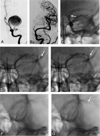 FIG 2.