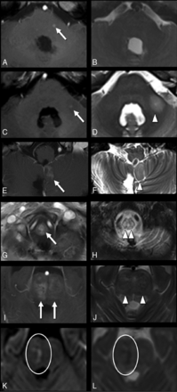 FIG 2.