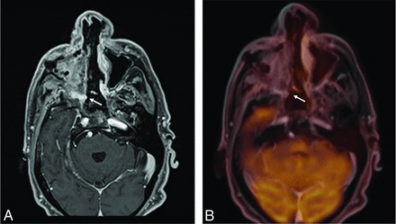 FIG 4.