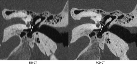 FIG 4.