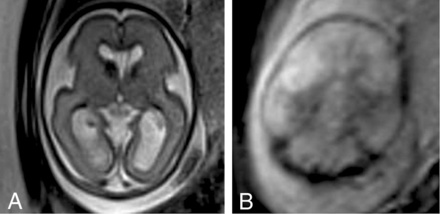 FIG 3.