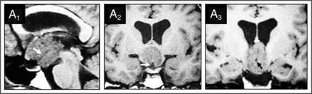 FIG 1.
