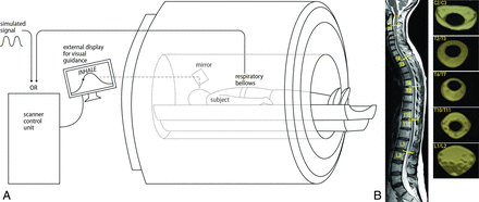 FIG 1.