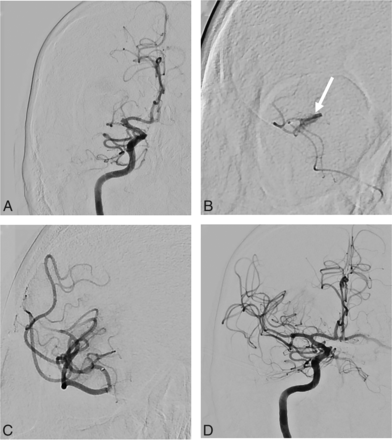 FIG 2.