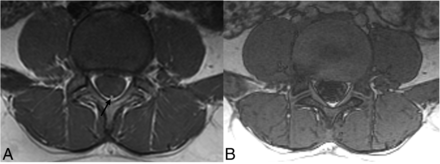 FIG 2.