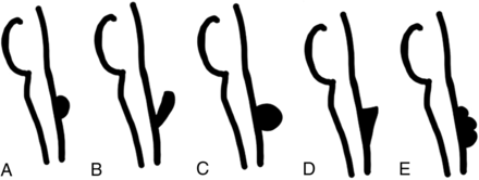 FIG 1.