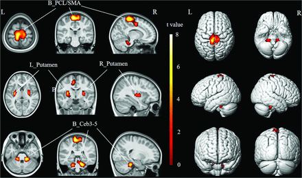FIG 3.