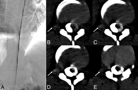 Fig 3.