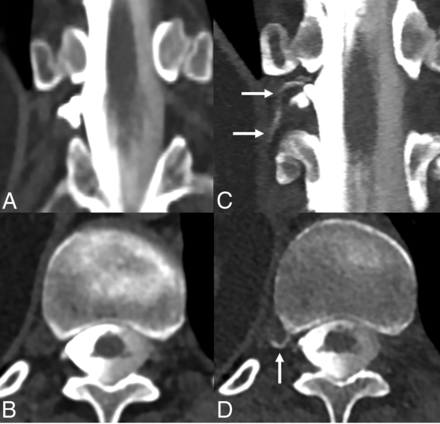Fig 5.