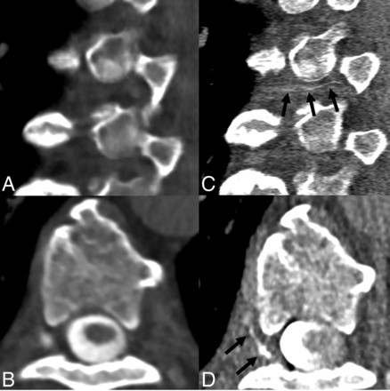 Fig 6.