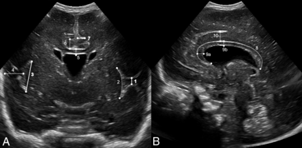 FIG 2.