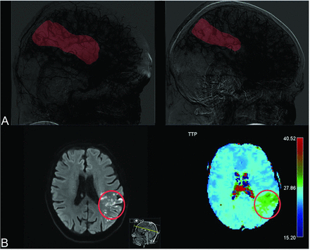 FIG 2.