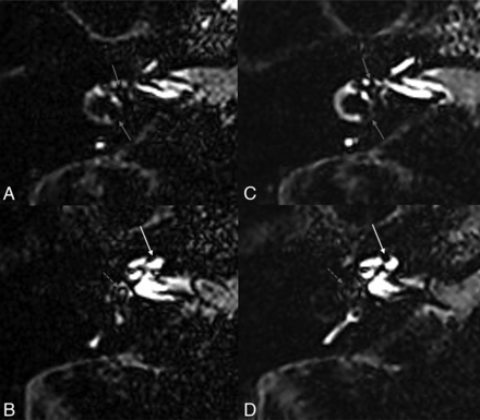 FIG 2.