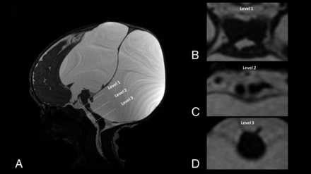 FIG 2.