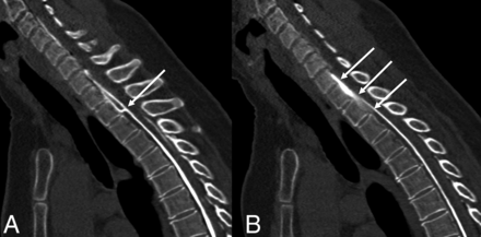FIG 2.