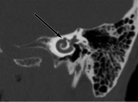 FIG 1.
