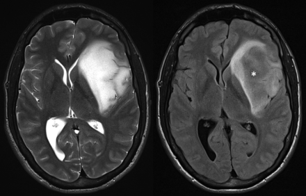 FIG 1.