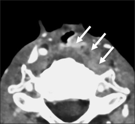 FIG 2.