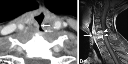 FIG 3.