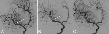 FIG 1.