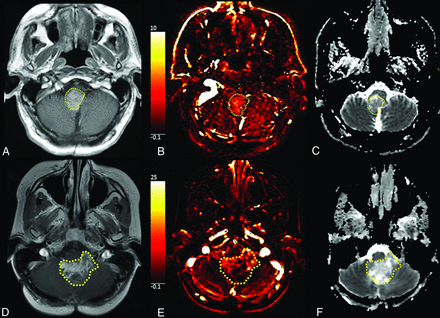 FIG 2.