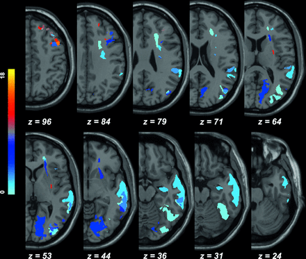 FIG 4.