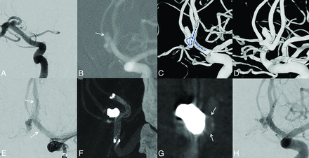 FIG 2.