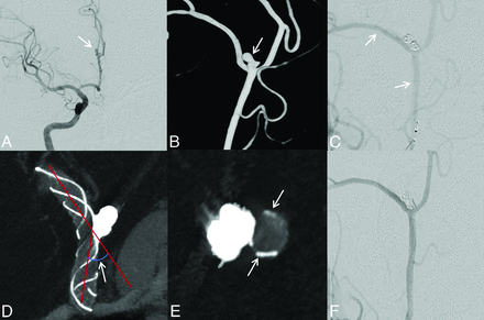 FIG 3.