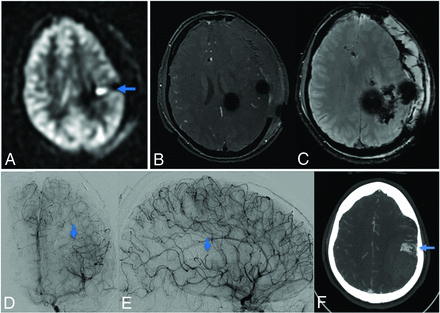 FIG 2.