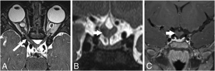 FIG 1.