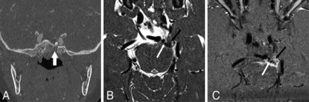 FIG 5.