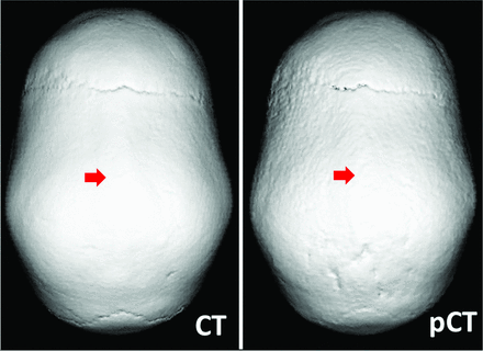 FIG 1.