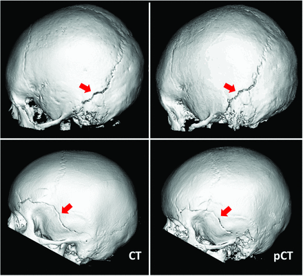 FIG 2.